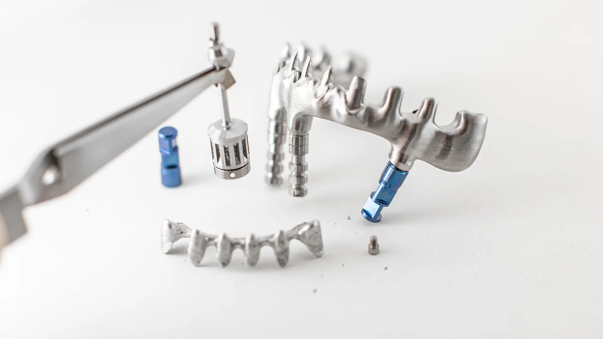 What Is 3D Guided Dental Implant Surgery