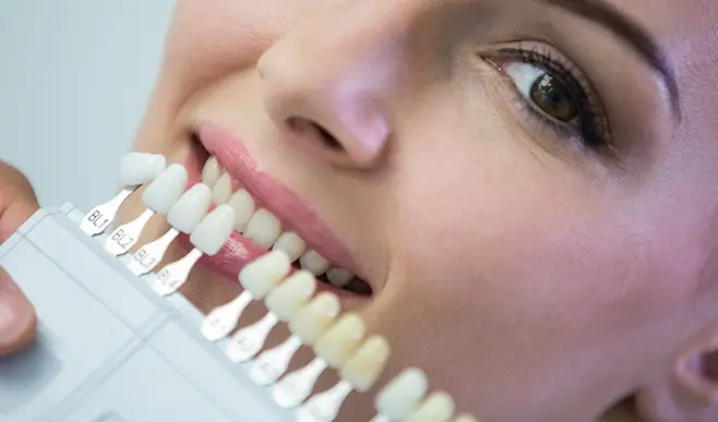 dentist-examining-female-patient-with-teeth-shades