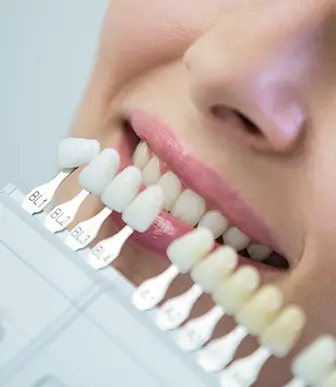 dentist-examining-female-patient-with-teeth-shades